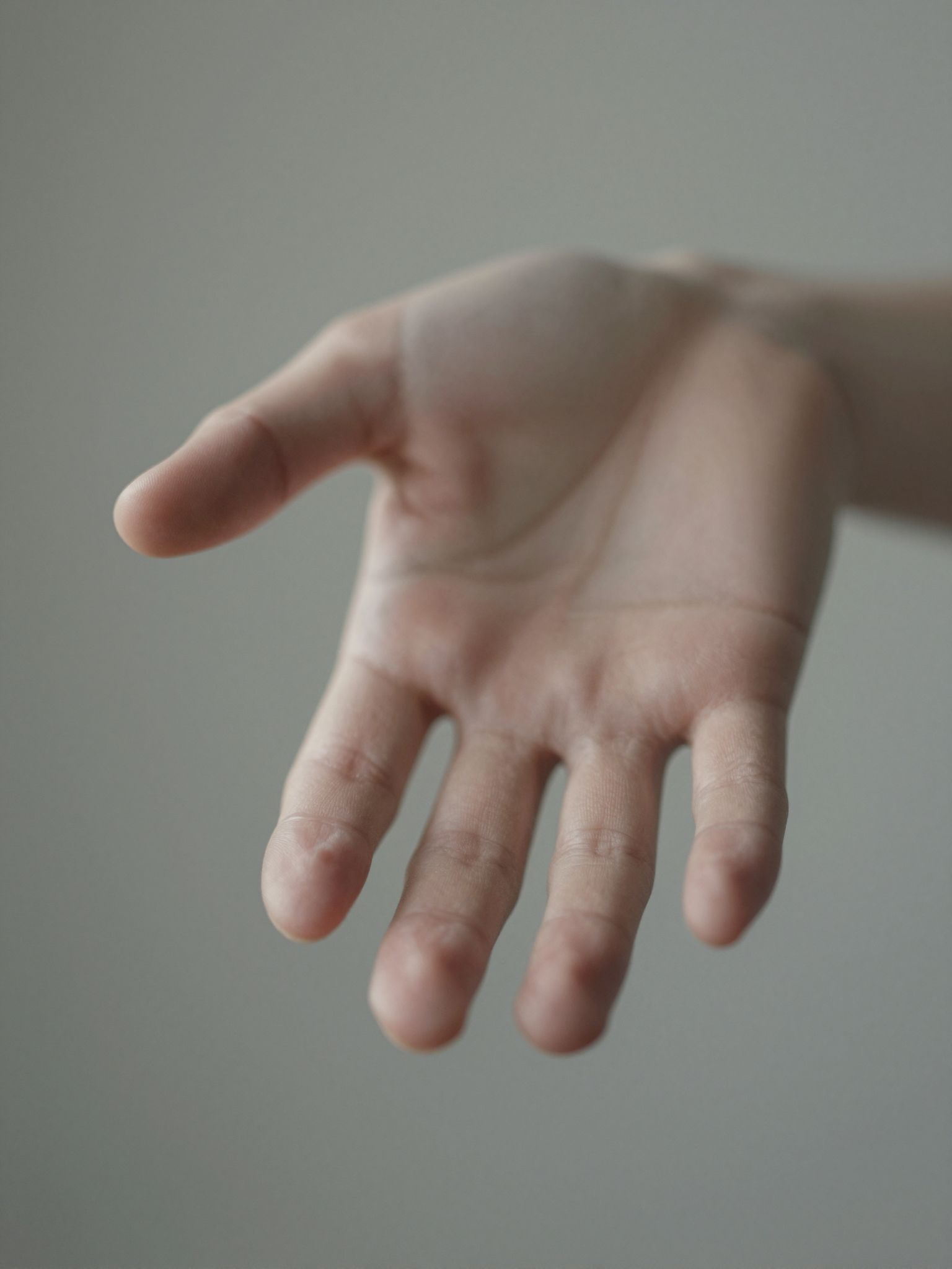 Az elveszett kéz álma a szabadság és a korlátok eltörlésének mély vágyát szimbolizálja a tudatalattidban.